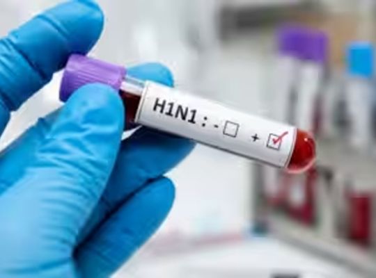 Rising Swine Flu outbreak in Uttarakhand! 73 cases detected; Health Department on alert.